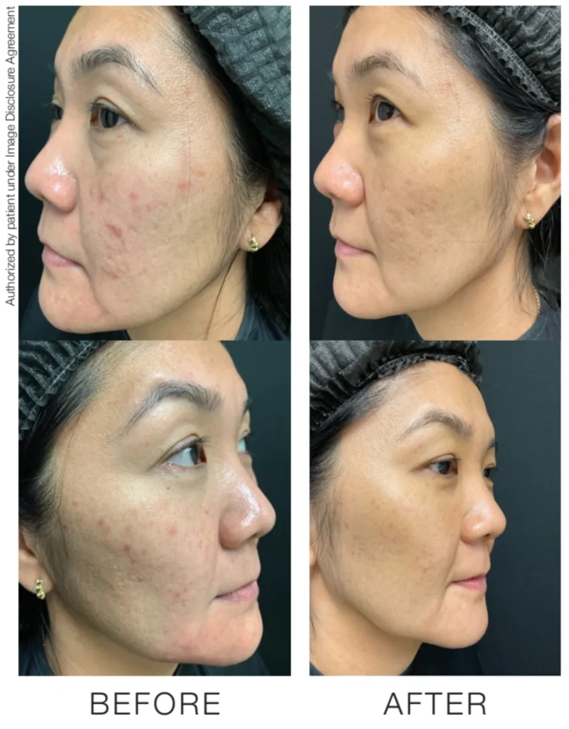 Aesthetic Treatments Park City